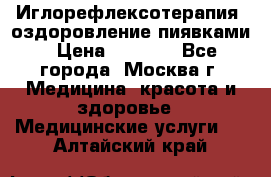 Иглорефлексотерапия, оздоровление пиявками › Цена ­ 3 000 - Все города, Москва г. Медицина, красота и здоровье » Медицинские услуги   . Алтайский край